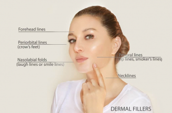 Effective Skincare Tips to Reduce Deep Wrinkles Around the Mouth