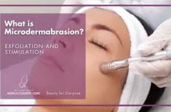 Can You Use Salicylic Acid After Microdermabrasion? Safety Explained