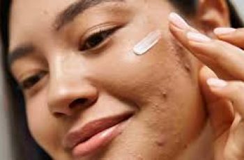 Does Moisturizer Help or Hurt Acne-Prone Skin?