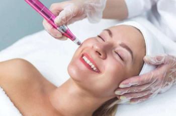Lactic Acid After Microneedling: Skincare Safety and Timing Tips