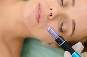 How to Safely Use Vitamin C After Microneedling Treatments
