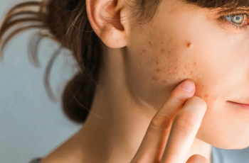 The Mood-Skin Connection: 5 Emotional Triggers That Affect Skin The Mood-Skin Connection: 5 Emotional Triggers That Affect Skin