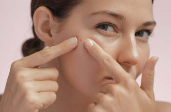 Busting Acne Myths: What Really Works for Clear Skin