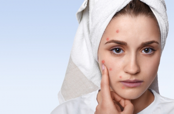 Azelaic Acid and Retin-A: Can They Work Together?