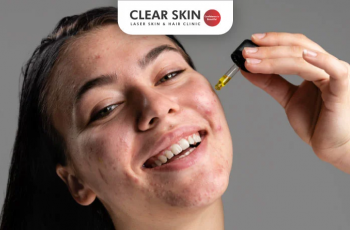 Salicylic Acid: How Much Is Too Much? Salicylic Acid: How Much Is Too Much?