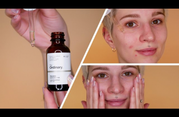 Stop Burning Your Face: The Nightly Mandelic Acid Mistake Dermatologists Beg You to Avoid